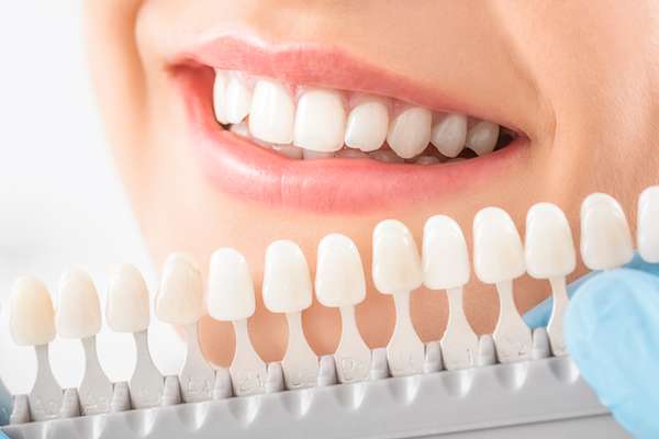 Caring For Veneers After A Cosmetic Dentist Treatment
