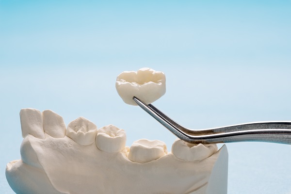 What Materials Are Dental Crowns Made Of?